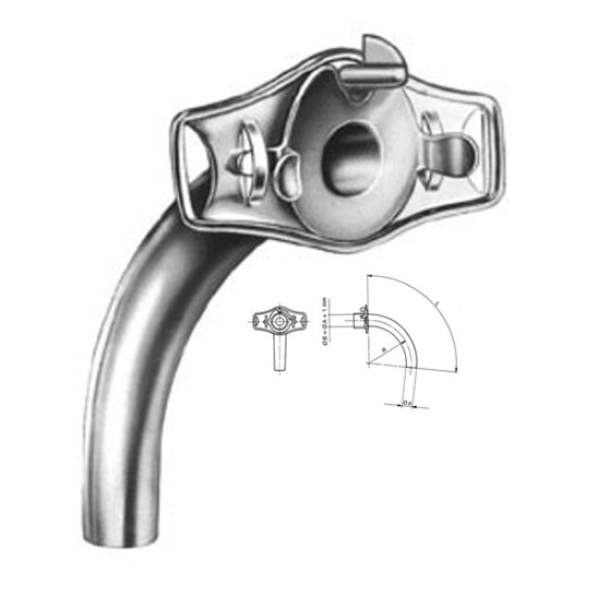 Tracheotomy